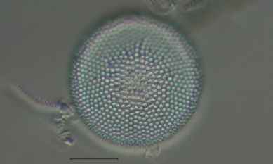 - Not Known - Actinocyclus normanii - Type: Phytoplankton