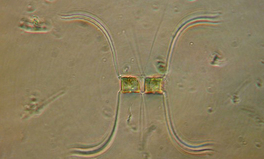- Not Known - Chaetoceros affinis - Type: Phytoplankton