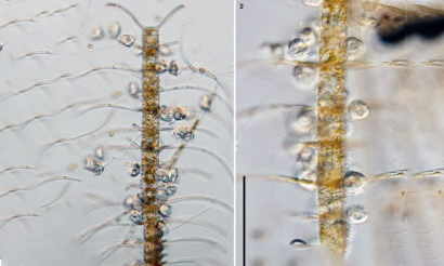 - Not Known - Chaetoceros coarctatus - Type: Phytoplankton