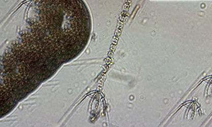 - Not Known - Chaetoceros compressus - Type: Phytoplankton