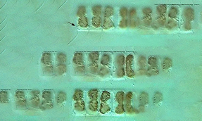 - Not Known - Chaetoceros costatus - Type: Phytoplankton