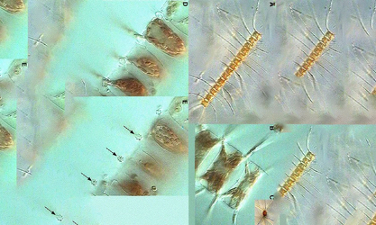 - Not Known - Chaetoceros eibenii - Type: Phytoplankton
