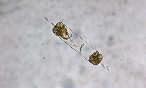 - Not Known - Ditylum sp. - Type: Phytoplankton