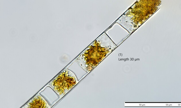 - Not Known - Hemiaulus hauckii - Type: Phytoplankton