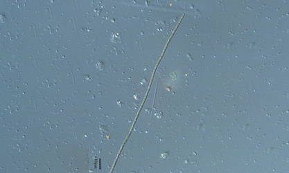- Not Known - Jaaginema geminatum - Type: Phytoplankton