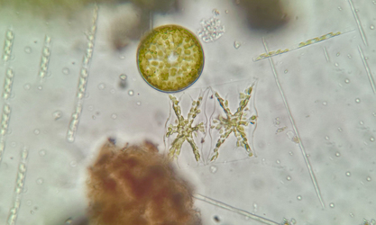 - Not Known - Mediopyxis helysia - Type: Phytoplankton