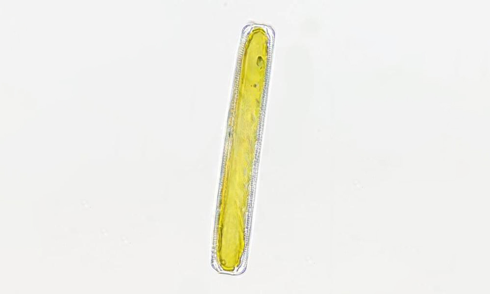 - Not Known - Pinnularia distans - Type: Phytoplankton
