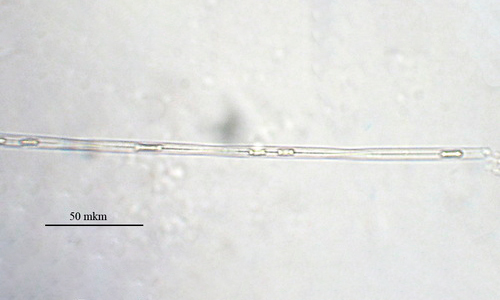 - Not Known - Pseudo-nitzschia delicatissima - Type: Phytoplankton