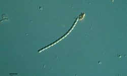 - Not Known - Pseudonitzschia sp - Type: Phytoplankton