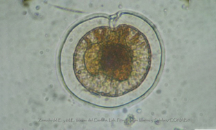 - Not Known - Pyrophacus steinii - Type: Phytoplankton